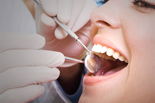 Take Advantage of Your Dental Insurance Benefits